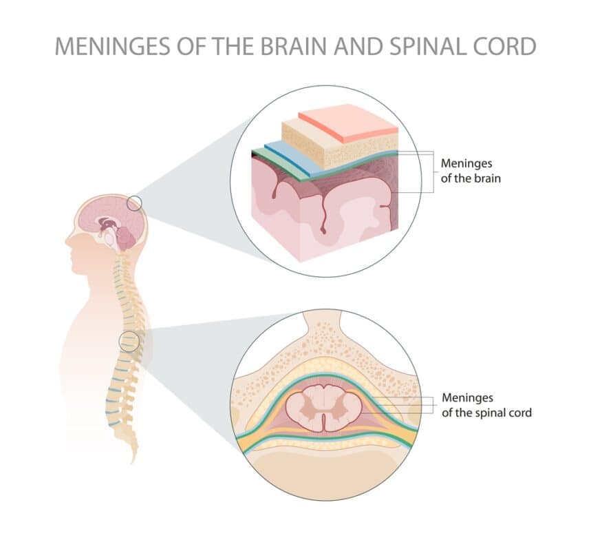 Depo-Provera-Brain-and-Spinal-Meningioma